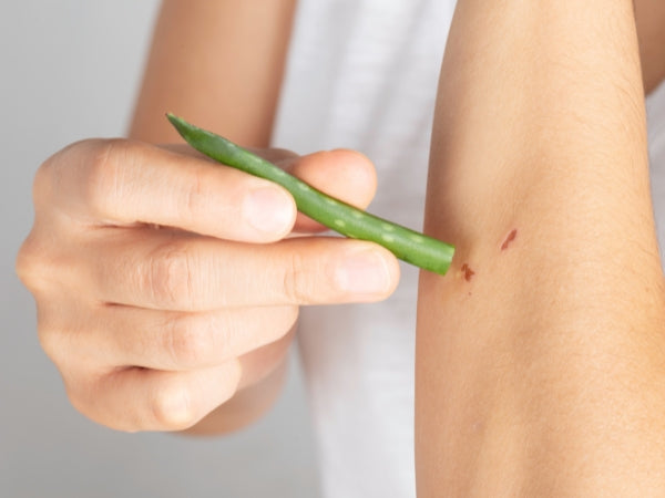 Aloe Vera for Wound Healing: Nature's Gift